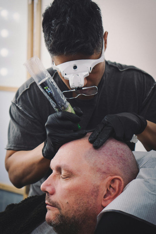How to Transform Your Confidence with the Power of Micropigmentation